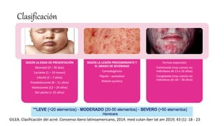 Clasificación
SEGÚN LA EDAD DE PRESENTACIÓN
Neonatal (0 – 30 días)
Lactante (1 – 24 meses)
Infantil (2 – 7 años)
Preadolescente (8 – 11 años)
Adolescente (12 – 24 años)
Del adulto (> 25 años)
SEGÚN LA LESIÓN PREDOMINANTE Y
EL GRADO DE SEVERIDAD
Comedogénico
Pápula – pustuloso
Nódulo quístico
Formas especiales
Fulminante (mas común en
individuos de 13 a 16 años)
Conglobata (mas común en
individuos de 18 – 30 años)
GILEA. Clasificación del acné. Consenso ibero latinoamericano, 2014. med cutan iber lat am 2019; 43 (1): 18 - 23
 