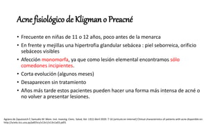 Acne fisiológico de Kligman o Preacné
• Frecuente en niñas de 11 o 12 años, poco antes de la menarca
• En frente y mejillas una hipertrofia glandular sebácea : piel seborreica, orificio
sebáceos visibles
• Afección monomorfa, ya que como lesión elemental encontramos sólo
comedones incipientes.
• Corta evolución (algunos meses)
• Desaparecen sin tratamiento
• Años más tarde estos pacientes pueden hacer una forma más intensa de acné o
no volver a presentar lesiones.
Agüero de Zaputovich F, Samudio M .Mem. Inst. Investig. Cienc. Salud, Vol. 13(1) Abril 2020: 7-16 [articulo en internet] Clinical characteristics of patients with acne disponible en:
http://scielo.iics.una.py/pdf/iics/v13n1/v13n1a03.pdf3.
 