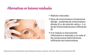Alternativas en lesiones residuales
• Nódulos indurados:
 Dosis de triamcinolona intralesional
diluida: acetónido de triamcinolona
diluida (3 cc de solución salina + 1 cc
de de triamcinolona) para infiltración
ID
 Si el nodulo es francamente
inflamatorio e indurado y no cede al
tto convencional administramos
infiltración de triamcinolona
Tratamiento del acné: efectividad de ciertos medicamentos tópicos y sistémicos. Hernandez, Bañuelos. Dermatol Rev Mex.2020
 