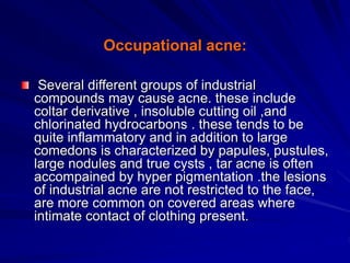 Occupational acne:
Several different groups of industrial
compounds may cause acne. these include
coltar derivative , insoluble cutting oil ,and
chlorinated hydrocarbons . these tends to be
quite inflammatory and in addition to large
comedons is characterized by papules, pustules,
large nodules and true cysts , tar acne is often
accompained by hyper pigmentation .the lesions
of industrial acne are not restricted to the face,
are more common on covered areas where
intimate contact of clothing present.
 