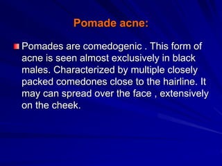 Pomade acne:
Pomades are comedogenic . This form of
acne is seen almost exclusively in black
males. Characterized by multiple closely
packed comedones close to the hairline. It
may can spread over the face , extensively
on the cheek.
 