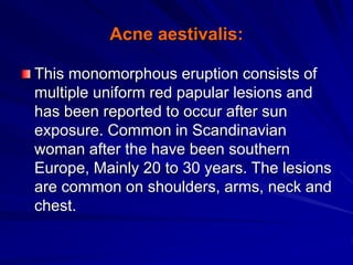 Acne aestivalis:
This monomorphous eruption consists of
multiple uniform red papular lesions and
has been reported to occur after sun
exposure. Common in Scandinavian
woman after the have been southern
Europe, Mainly 20 to 30 years. The lesions
are common on shoulders, arms, neck and
chest.
 