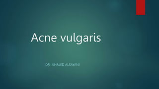 Acne vulgaris
DR : KHALED ALSAYANI
 