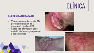 Acné enfoque médico, fisiopatologia y tratamiento.pptx