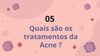 Quais são os
tratamentos da
Acne ?
05
 