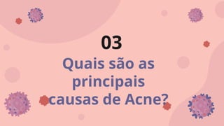 Quais são as
principais
causas de Acne?
03
 