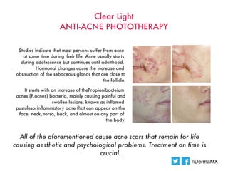 Clear Light
                       ANTI-ACNE PHOTOTHERAPY

  Studies indicate that most persons suffer from acne
    at some time during their life. Acne usually starts
   during adolescence but continues until adulthood.
           Hormonal changes cause the increase and
 obstruction of the sebaceous glands that are close to
                                            the follicle.

     It starts with an increase of thePropionibacteium
 acnes (P.acnes) bacteria, mainly causing painful and
                    swollen lesions, known as infamed
 pustulesorinfammatory acne that can appear on the
  face, neck, torso, back, and almost on any part of
                                              the body.


  All of the aforementioned cause acne scars that remain for life
causing aesthetic and psychological problems. Treatment on time is
                             crucial.
                                                             /iDermaMX
 