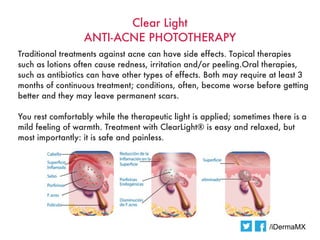 Clear Light
                  ANTI-ACNE PHOTOTHERAPY
Traditional treatments against acne can have side effects. Topical therapies
such as lotions often cause redness, irritation and/or peeling.Oral therapies,
such as antibiotics can have other types of effects. Both may require at least 3
months of continuous treatment; conditions, often, become worse before getting
better and they may leave permanent scars.

You rest comfortably while the therapeutic light is applied; sometimes there is a
mild feeling of warmth. Treatment with ClearLight® is easy and relaxed, but
most importantly: it is safe and painless.




                                                                      /iDermaMX
 