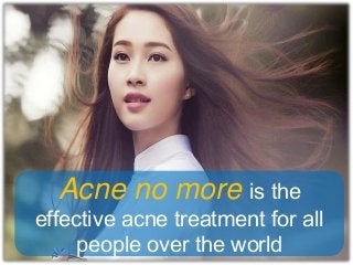 Acne no more is the

effective acne treatment for all
people over the world

 