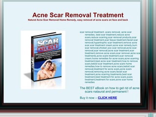 Acne Scar Removal Treatment Natural Acne Scar Removal Home Remedy, easy  removal of acne scars on face and back ,[object Object]