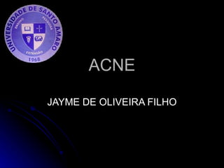 ACNE JAYME DE OLIVEIRA FILHO 
