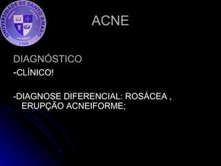 ACNE DIAGNÓSTICO - CLÍNICO! -DIAGNOSE DIFERENCIAL: ROSÁCEA , ERUPÇÃO ACNEIFORME; 