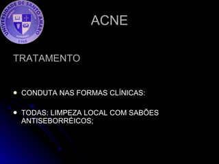 ACNE TRATAMENTO CONDUTA NAS FORMAS CLÍNICAS: TODAS: LIMPEZA LOCAL COM SABÕES ANTISEBORRÉICOS; 