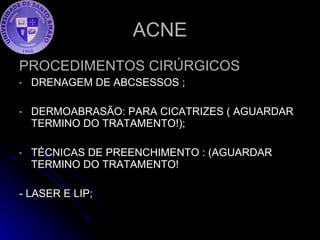 ACNE PROCEDIMENTOS CIRÚRGICOS DRENAGEM DE ABCSESSOS ; DERMOABRASÃO: PARA CICATRIZES ( AGUARDAR TERMINO DO TRATAMENTO!); TÉCNICAS DE PREENCHIMENTO : (AGUARDAR TERMINO DO TRATAMENTO! - LASER E LIP; 