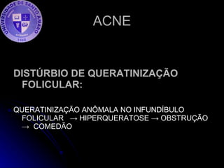 ACNE DISTÚRBIO DE QUERATINIZAÇÃO   FOLICULAR:   QUERATINIZAÇÃO ANÔMALA NO INFUNDÍBULO FOLICULAR  -> HIPERQUERATOSE -> OBSTRUÇÃO  ->  COMEDÃO  
