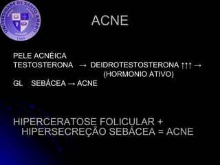 ACNE PELE ACNÉICA TESTOSTERONA  ->  DEIDROTESTOSTERONA ↑↑↑ ->  (HORMONIO ATIVO) GL  SEBÁCEA -> ACNE HIPERCERATOSE FOLICULAR + HIPERSECREÇÃO SEBÁCEA = ACNE 