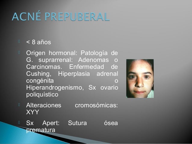 El ungüento de los puntos negros sobre la persona barata las revocaciones
