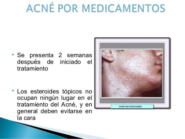 La crema el gel anti el acné comprar