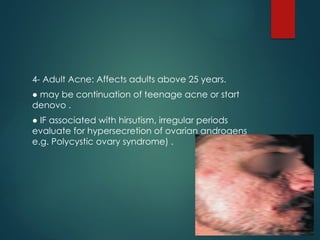 ACNE AND ACNEIFORM ERUPTIONS presentation II.pptx