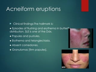 ACNE AND ACNEIFORM ERUPTIONS presentation II.pptx
