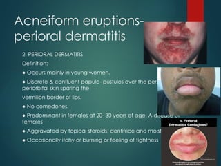 ACNE AND ACNEIFORM ERUPTIONS presentation II.pptx