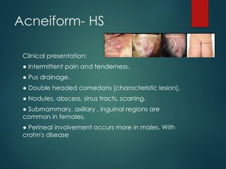 ACNE AND ACNEIFORM ERUPTIONS presentation II.pptx