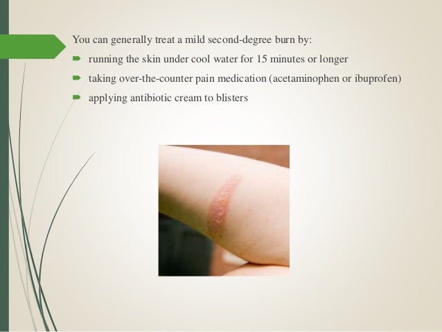 burnt skin from acne cream