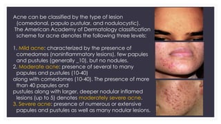 acne and rosacea - priyanga jayaraman.pptx