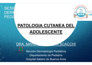 SESION INTERACTIVA
DERMATOLOGIA EN LENGUAJE
PEDIATRICO
PATOLOGIA CUTANEA DEL
ADOLESCENTE
ADOLESCENTE
DRA. MARIA FLORENCIA SCACCHI
Sección Dermatología Pediátrica
Departamento de Pediatría
Hospital Italiano de Buenos Aires
DERMATOLOGIA EN LENGUAJE
PATOLOGIA CUTANEA DEL
ADOLESCENTE
ADOLESCENTE
DRA. MARIA FLORENCIA SCACCHI
Sección Dermatología Pediátrica
Departamento de Pediatría
Hospital Italiano de Buenos Aires
 