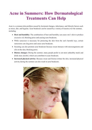 Acne in Summers: How Dermatological
Treatments Can Help
Acne is a common skin problem caused by hormonal changes, inheritance, and lifestyle factors such
as stress, diet, and hygiene. Acne breakouts can be caused by a variety of reasons over the summer,
including:
 Heat and humidity: The combination of heat and humidity can cause one’s skin to produce
excessive oil, blocking pores and causing acne breakouts.
 While sunscreen is necessary for protecting the skin from the sun's harmful rays, certain
sunscreens can clog pores and cause acne breakouts.
 Sweating can also promote acne breakouts because sweat interacts with microorganisms and
oils on the skin, blocking pores.
 Dietary changes: During the summer, many people prefer to eat more unhealthy meals and
drink more alcohol, which can contribute to acne breakouts.
 Increased physical activity: Because sweat and friction irritate the skin, increased physical
activity during the summer can also result in acne breakouts.
 