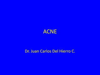 ACNE
Dr. Juan Carlos Del Hierro C.
 