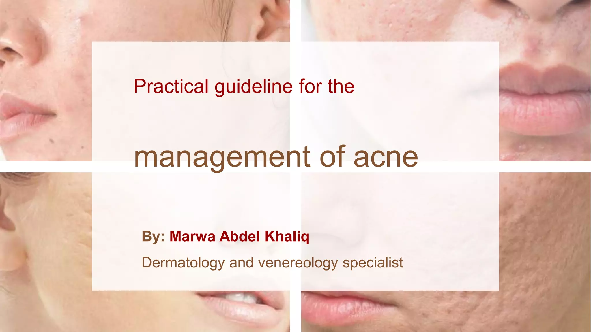 Acne Management Algorithm Practical guideline for the acne management | PPTX