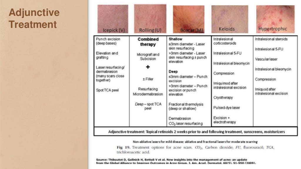 Practical guideline for the acne management