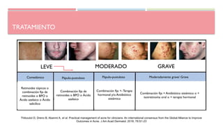 TRATAMIENTO
LEVE MODERADO GRAVE
Comedónico Pápulo-pustuloso Moderadamente grave/ Grave
Retinoides tópicos o
combinación fija de
retinoides o BPO o
Ácido azelaico o Ácido
salicílico
Combinación fija de
retinoides o BPO o Ácido
azelaico
Combinación fija +- Terapia
hormonal y/o Antibiótico
sistémico
Combinación fija + Antibiótico sistémico o +
isotretinoína oral o + terapia hormonal
Pápulo-pustuloso
Thiboutot D, Dreno B, Abanmi A, et al. Practical management of acne for clinicians: An international consensus from the Global Alliance to Improve
Outcomes in Acne. J Am Acad Dermatol. 2018; 78:S1-23
 