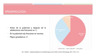 EPIDEMIOLOGÍA
 Antes de la pubertad y después de la
adolescencia más frecuente en ♀.
 En la pubertad más frecuente en varones.
 Mayor gravedad en ♂.
Tan J, Bhate K. A global perspective on the epidemiology of acne. British Journal of Dermatology. 2015; 172(1): 3-12.
Acné leve
61%
Acné moderado
30%
Acné grave
9%
Acné leve Acné moderado Acné grave
 