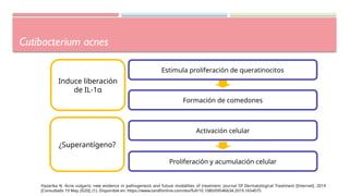 Cutibacterium acnes
Induce liberación
de IL-1α
Estimula proliferación de queratinocitos
Formación de comedones
Activación celular
Proliferación y acumulación celular
¿Superantígeno?
Hazarika N. Acne vulgaris: new evidence in pathogenesis and future modalities of treatment. Journal Of Dermatological Treatment [Internet]. 2019
[Consultado 19 May 2020]; (1). Disponible en: https://www.tandfonline.com/doi/full/10.1080/09546634.2019.1654075
 
