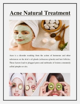 Acne Natural Treatment
Acne is a disorder resulting from the action of hormones and other
substances on the skin’s oil glands (sebaceous glands) and hair follicles.
These factors lead to plugged pores and outbreaks of lesions commonly
called pimples or zits.
 