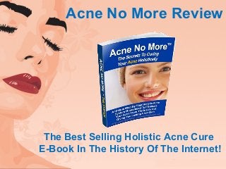 Acne No More Review
The Best Selling Holistic Acne Cure
E-Book In The History Of The Internet!
 