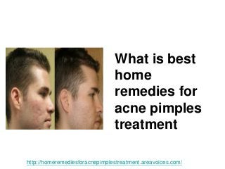 What is best
home
remedies for
acne pimples
treatment
http://homeremediesforacnepimplestreatment.areavoices.com/
 