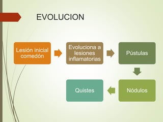EVOLUCION
Lesión inicial
comedón
Evoluciona a
lesiones
inflamatorias
Pústulas
NódulosQuistes
 