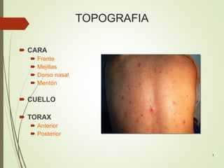 TOPOGRAFIA
 CARA
 Frente
 Mejillas
 Dorso nasal
 Mentón
 CUELLO
 TORAX
 Anterior
 Posterior
1
 