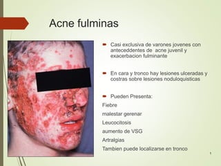 1
Acne fulminas
 Casi exclusiva de varones jovenes con
anteceddentes de acne juvenil y
exacerbacion fulminante
 En cara y tronco hay lesiones ulceradas y
costras sobre lesiones noduloquisticas
 Pueden Presenta:
Fiebre
malestar gerenar
Leucocitosis
aumento de VSG
Artralgias
Tambien puede localizarse en tronco
 