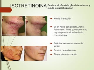 ISOTRETINOINA
 No de 1 elección
 SI en Acné conglobata, Acné
Fulminans, Acné queloideo o no
hay respuesta al tratamiento
convencional
 Solicitar exámenes antes de
iniciar
 Prueba de embarazo
 Firmar de autorización
Produce atrofia de la glandula sebacea y
regula la queratinización
 