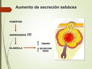 PUBERTAD
ANDROGENOS
GLANDULA
TAMAÑO
SECRECION
SEBO
Aumento de secreción sebácea
 