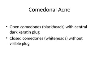Comprehensive Overview of Acne Vulgaris Types and Risk Factors | PPTX