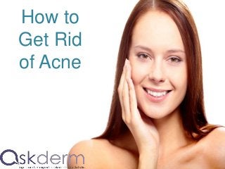 How to
Get Rid
of Acne
 