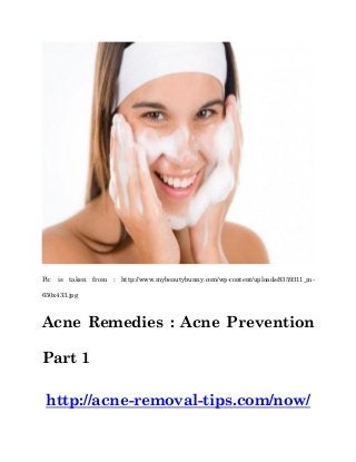Pic is taken from : http://www.mybeautybunny.com/wp-content/uploads/8359311_m-
650x433.jpg
Acne Remedies : Acne Prevention
Part 1
http://acne-removal-tips.com/now/
 