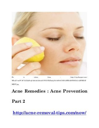 Pic is taken from : http://1.bp.blogspot.com/-
WSzuUvwaPC4/T15JLXoPoqI/AAAAAAAAAJU/VGbYXJXmJpY/s1600/ACNE%2BTRADITIONAL%2BTREAT
MENT.jpg
Acne Remedies : Acne Prevention
Part 2
http://acne-removal-tips.com/now/
 
