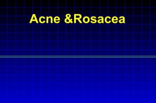 Acne &Rosacea 