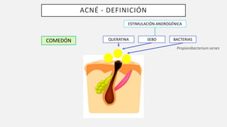 ACNÉ - DEFINICIÓN
COMEDÓN QUERATINA SEBO BACTERIAS
ESTIMULACIÓN ANDROGÉNICA
Propionibacterium acnes
 